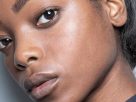 How to Get Rid of Blackheads on Your Nose, Chin, and Forehead
